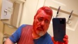  Nobel Peace Prize-winning editor Dmitry Muratov takes a selfie after he was attacked on a Russian train by an assailant who poured red paint on him, April 7, 2022. (Novaya Gazeta Europe's Telegram channel via AP)