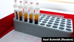 Blood samples are prepared for testing for the corona virus at a laboratory in Berlin, Germany, March 26, 2020.