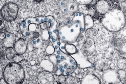 A microscopic image of SARS-CoV-2 or Severe Acute Respiratory Syndrome Coronavirus 2 from the first U.S. COVID-2019 case, CDC media library