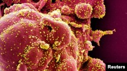 Colorized scanning electron micrograph of an apoptotic cell (red) infected with SARS-COV-2 virus particles (yellow), isolated from a patient sample. National Institute of Allergy and Infectious Diseases, NIH/Handout via REUTERS. 