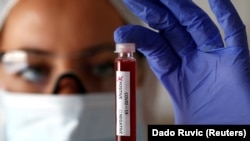 FILE PHOTO: Fake blood is seen in test tubes labeled with the coronavirus (COVID-19) in this illustration taken March 17, 2020. 