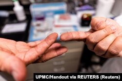 Fingertip-sized patches with dissolvable microscopic needles, a potential COVID-19 vaccine, are seen at the University of Pittsburgh, Pittsburgh, Pennsylvania.