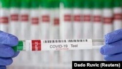 FILE PHOTO: A test tube labeled "COVID-19 Test positive" is seen in this illustration picture taken, March 10, 2021.