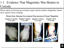 A screen capture from http://russian-untouchables.com with photographic evidence documenting beatings Sergei Magnitsky received in prison.