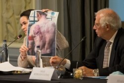 BELGIUM -- Belarusian opposition leader Svyatlana Tsikhanouskaya shows torture pictures next to EU foreign policy chief Josep Borrell during an informal breakfast with EU foreign affairs ministers on September 21, 2020.
